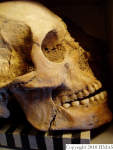 L_V20d5018 A16.175 R814 lR ta cranium